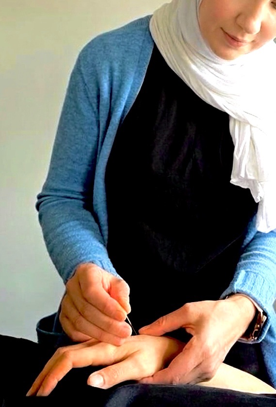 A qualified female practitioner giving an acupuncture treatment to a woman at Vireya Wellness in Marylebone